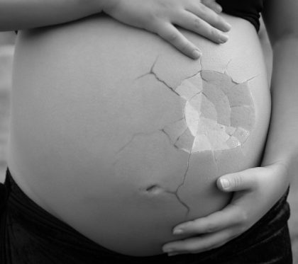 Abortos de repetición en reproducción asisitida